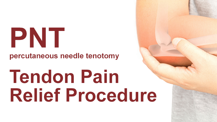 PNT: percutaneous needle tenotomy Tendon Pain Relief Procedure